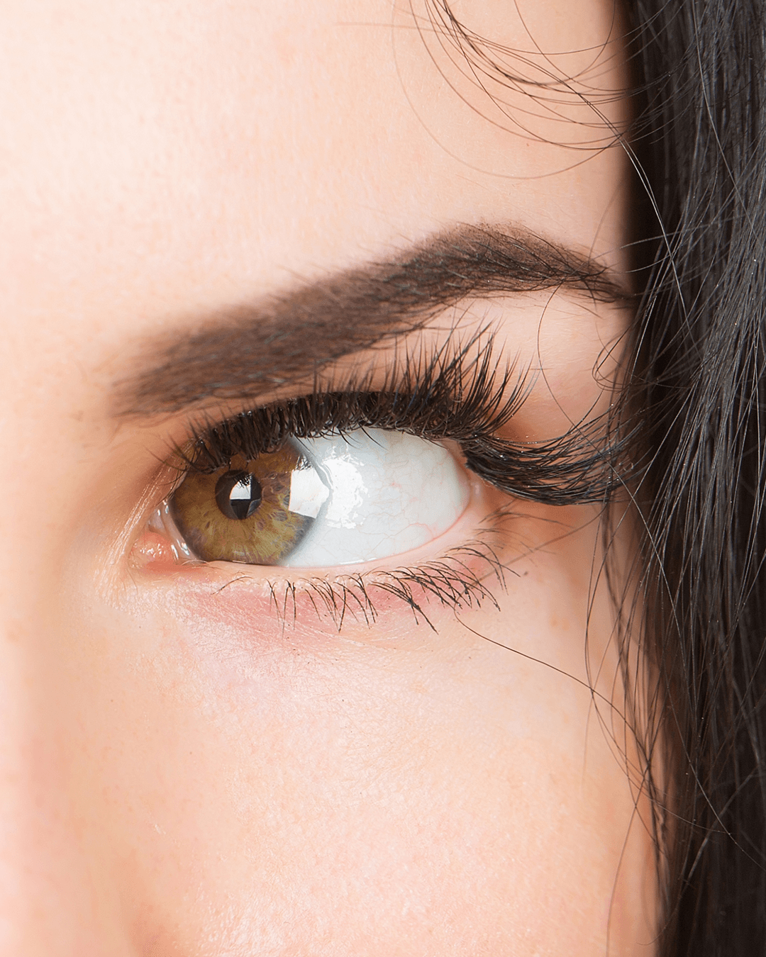 Surgical correction of strabismus (crossed or misaligned eyes) in children and adults at The Eye Doctor