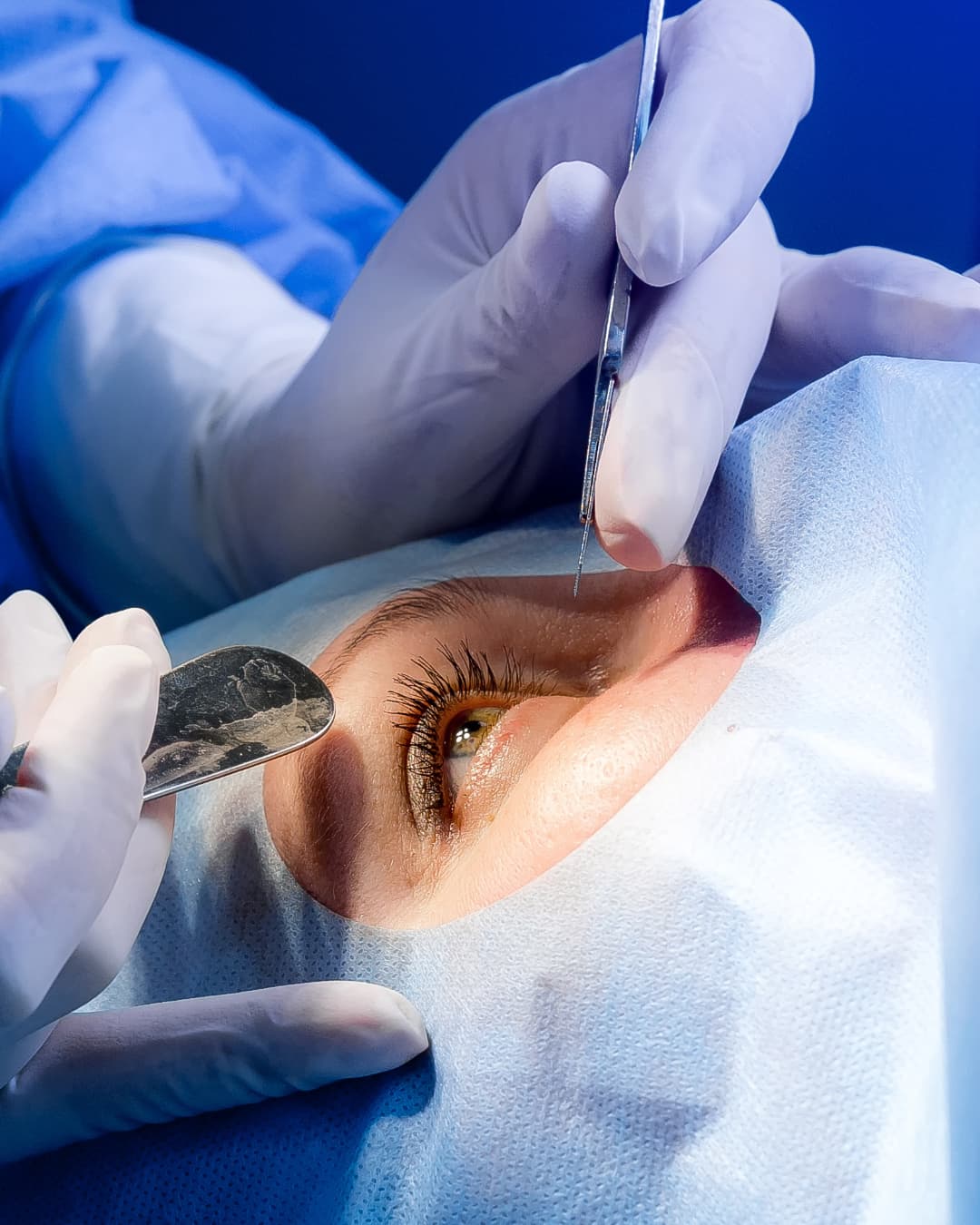 Specialist vitreoretinal surgery for retinal detachment and complex retinal conditions at The Eye Doctor